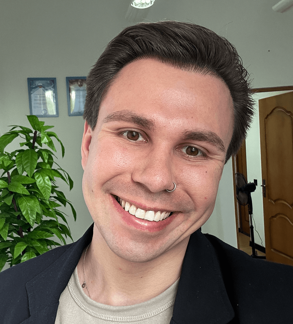 результаты пересадки волос 