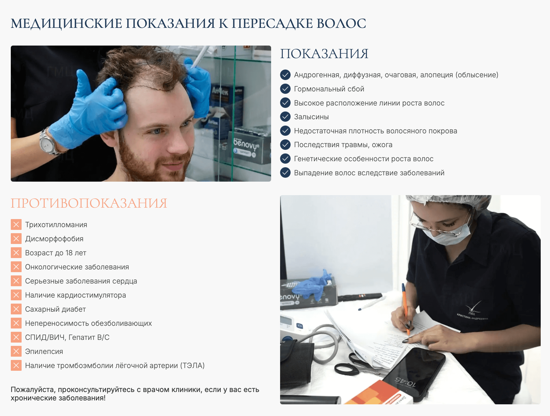 Показания к пересадке волос